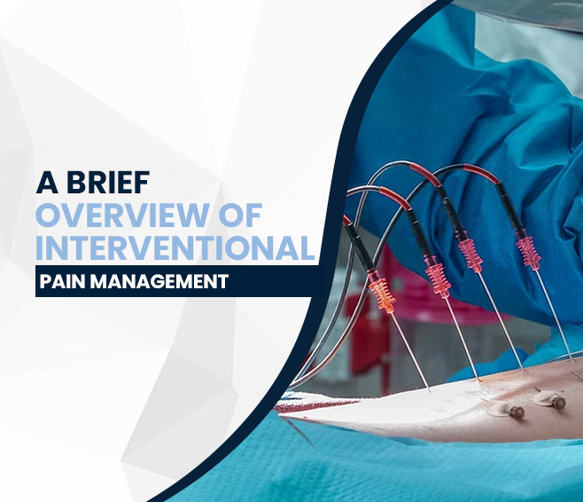 A Brief Overview of Interventional Pain Management