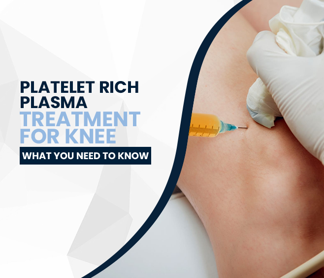 Platelet-Rich Plasma (PRP) Treatment for Knee