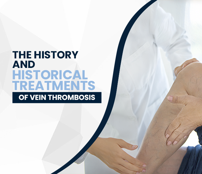 The History And Historical Treatments Of Vein Thrombosis