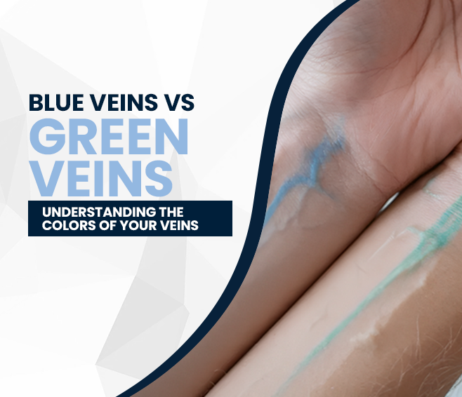 Blue Veins Vs. Green Veins