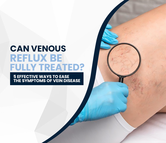 Can Venous Reflux Be Fully Treated?