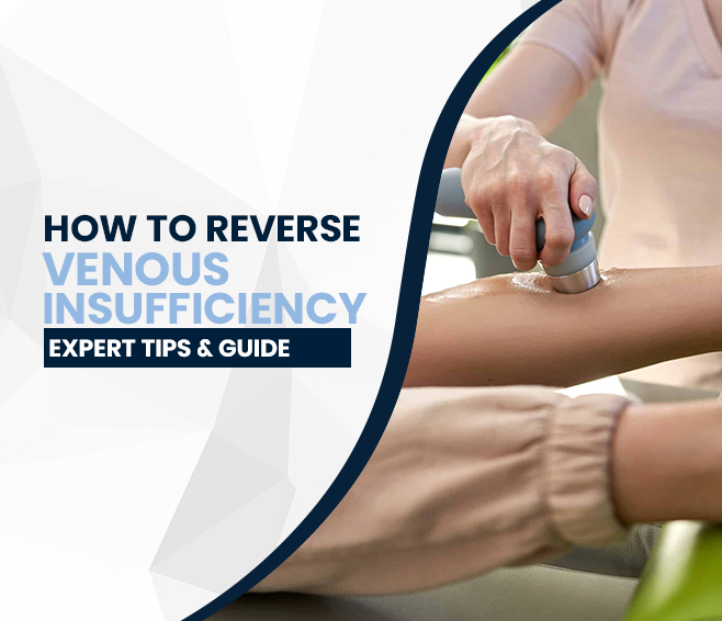 How to Reverse Venous Insufficiency