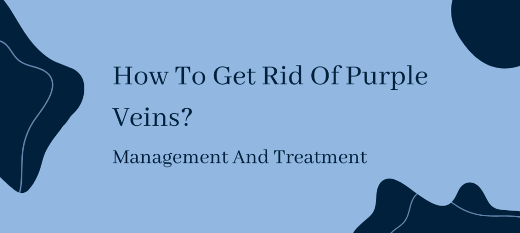 rid of purple veins